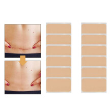 2 Boxes Narbe Abdeckpflaster, wasserdicht, latexfrei, weich und atmungsaktiv, für Tattoo-Fehler und Narben, Conceal-Patch