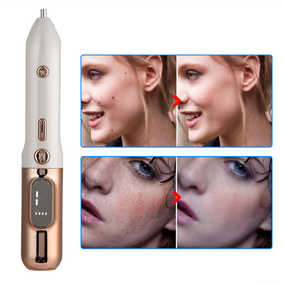Gold Spot Mole Removal Pen 1200Mah Skin Beauty Instrument