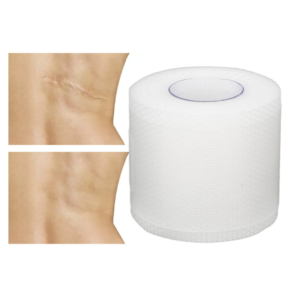 Breathable 3m Silicone Scar Repair Tape for Surgery & Burns