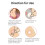 Invisible Acne Pimple Patch for Daytime Use - Protective Barrier 4