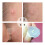 Invisible Acne Pimple Patch for Daytime Use - Protective Barrier 6