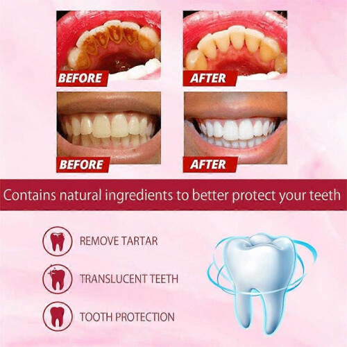 (3pcs)NEW SP-4 Probiotic Toothpaste, Yayashi Sp-4 Toothpaste Whitening 120g 2