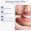 Solid Dental Glue - Temporary Fillings for Teeth & Dentures, Easy to Use, Durable Adhesive 3
