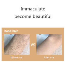 Tragbares Haarentfernungsgerät sanfte Haarentfernung und Peeling für Frauen