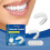 (Set) Night teeth protection suit, fresh oral protection teeth, comfortable oral protection teeth 2