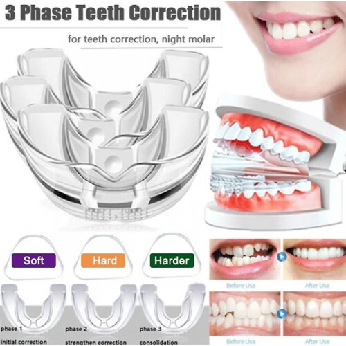 3pcs/set Dental Tooth Orthodontic Appliance Trainer for Alignment Braces