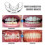 3pcs/set Dental Tooth Orthodontic Appliance Trainer for Alignment Braces 2