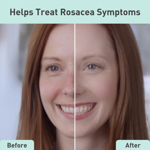 Procure Rosacare CC Hydrogel 2 fl oz 1