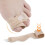 Corrector para dedo martillo, talla única, 9,0 g, piel 3