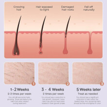 Uusi Bikini IPL 999999 Flash Epilator Impulse Permanent Laser Epilator