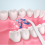 3 Modes al Irrigator Portable Dental, Vihreä 4 suutin 4
