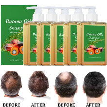 5PC Batana Oil Shampoo, Shampoo De Batana, Rosemary Oil Shampoo 100ml