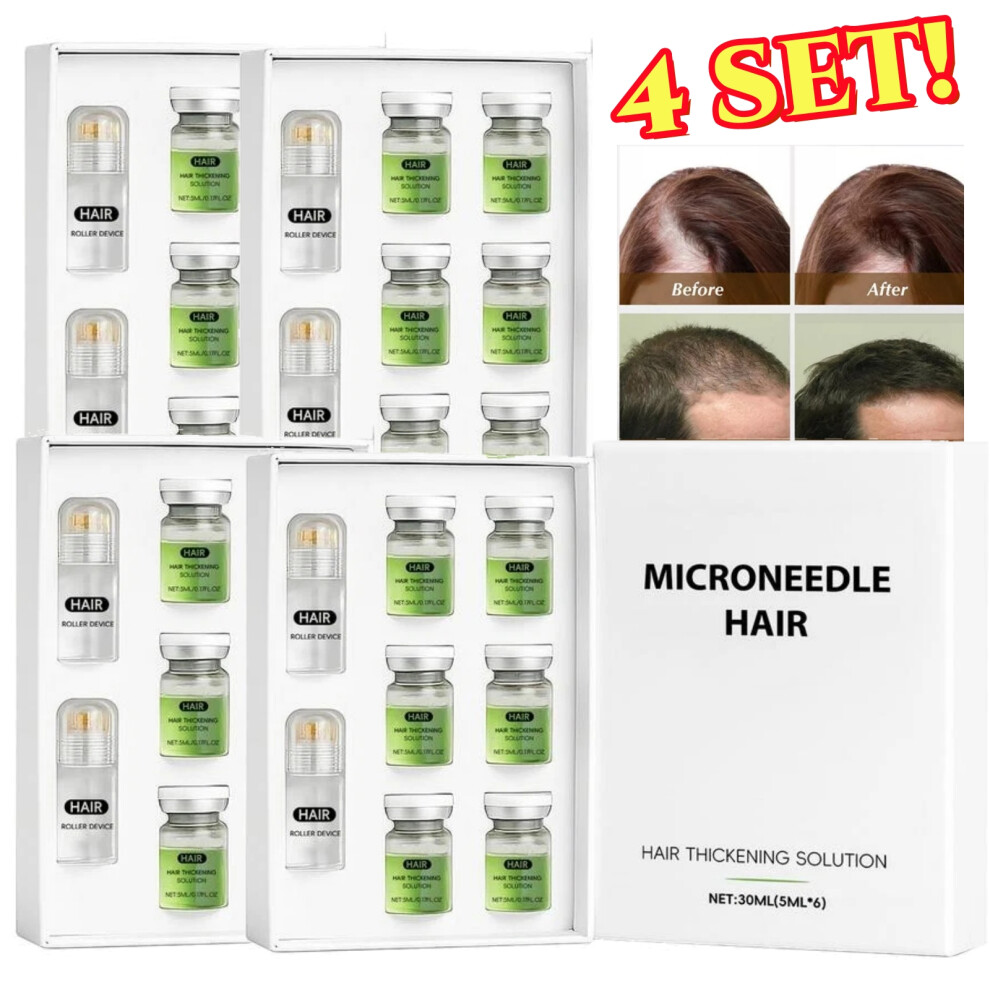 4Set Alphainfuse Hair Regrowth System, Advanced Hair Growth Treatment Ginseng