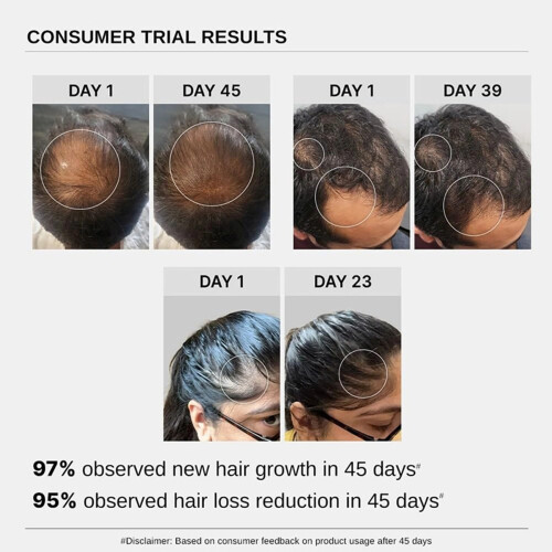 2X Bare Anatomy Advanced Hair Growth Serum - 30ml 1