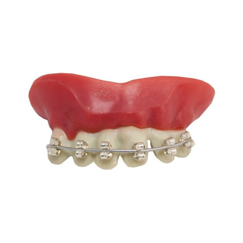 Rubies Denture braces