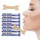 Ventilating Nasal Strips, Pack of 100, Nasal Strips Nasal Strips 1