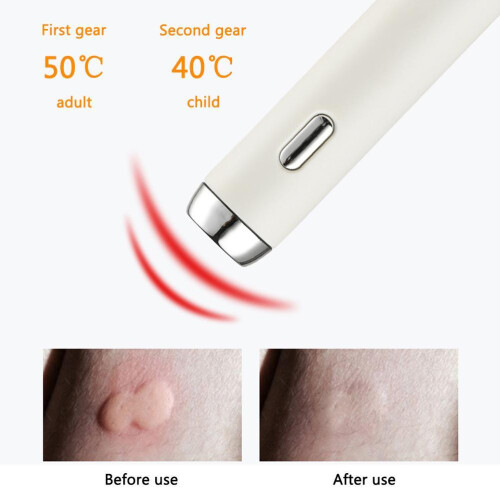Heat Pulse Anti Itch Pen Electronic Relieve 2