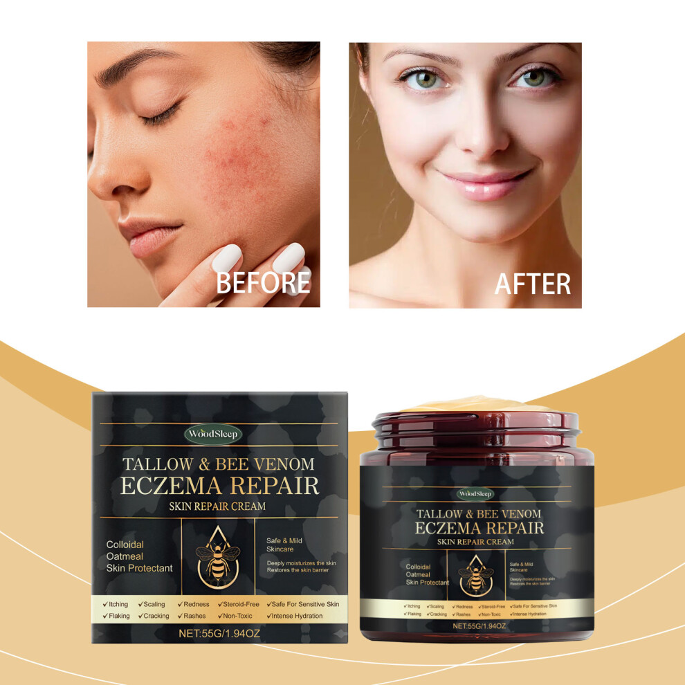 WOODSLEEP Skin Repair Cream, Tallow & Bee Venom Eczema Repair Cream, Skin Repair Cream-image-OPC-PJRD6JX-NEW