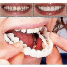 Upper & Lower High Quality Denture Instant Smile Comfort