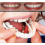 Upper & Lower High Quality Denture Instant Smile Comfort 1