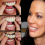 Upper & Lower High Quality Denture Instant Smile Comfort 3