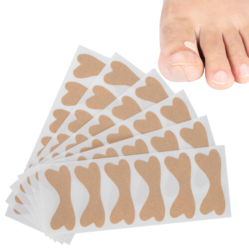 Patch pour ongle incarné, ensemble de 36 pièces, 4,5  1,8 cm