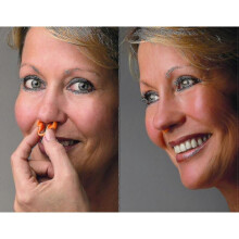 3pcs Anti Snoring Nasal Dilator Transparent - Nose Breathing Middle - Nasal Congestion Prevention Tw