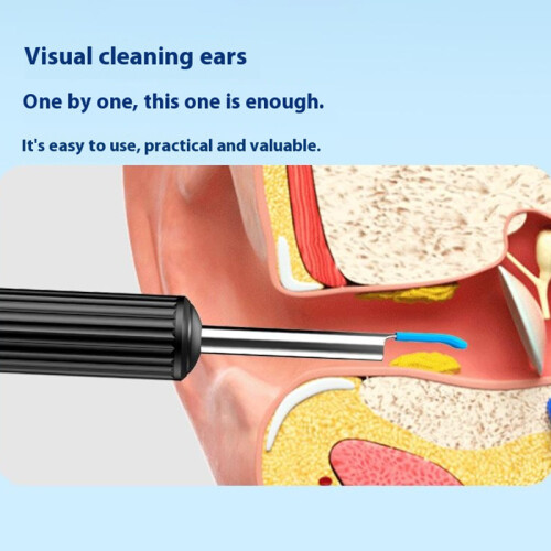 (Black) Visual Ear Cleaning Endoscope with LED Light Earwax Removal Tool Kit,Upgraded Version 1