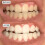 Smile Science Teeth Whitening Pen 9