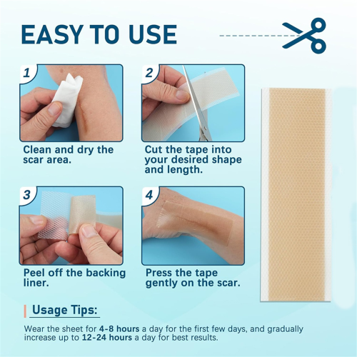 Silikon-Narben-Abdeckpaste, Silikon-Klebeband, zum Abdecken verwendet, wiederverwendbare Paste 2