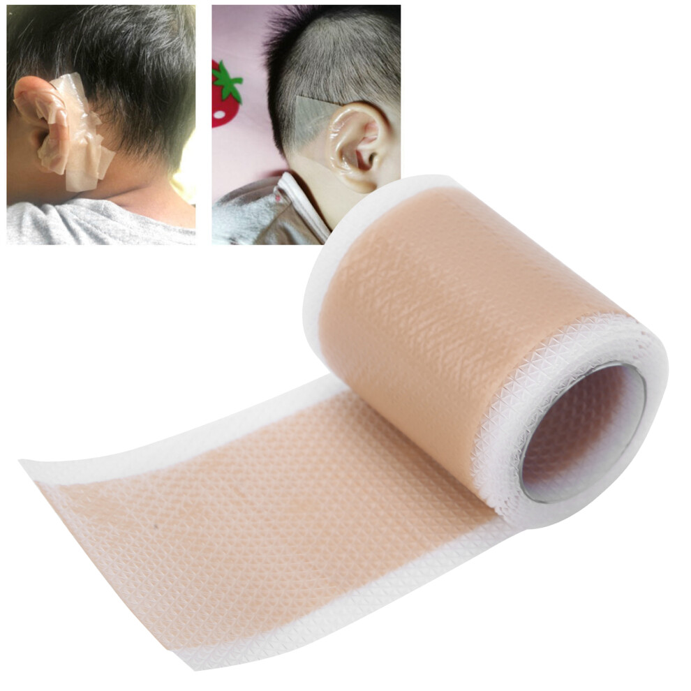 Silicone Kids Ear Corrector Stickers For Protruding Ears, 4X100cm Unisex Kids