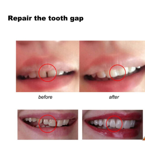 Solid Tooth Glue Tooth Repair Granules DIY Vampire 2