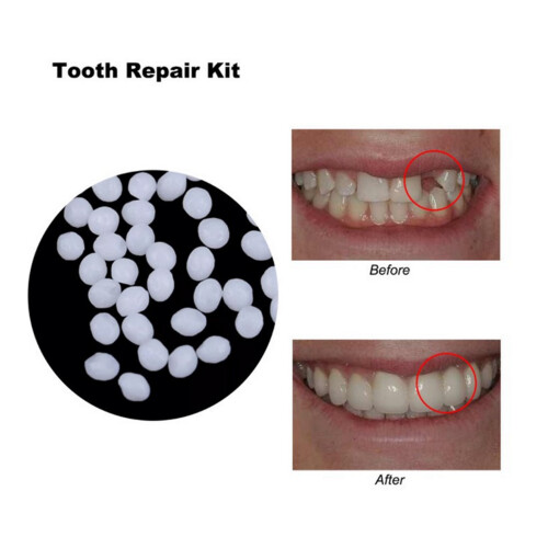 Solid Tooth Glue Tooth Repair Granules DIY Vampire