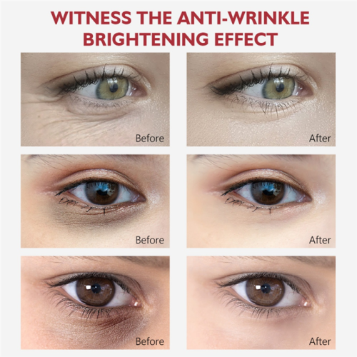 Creme para os olhos com nicotinamida remove olheiras e bolsas sob os olhos 1