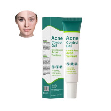MOOYAM Acne Control Gel Clears Acne 30g | Acne Spot Gel | Pimple Cream for Acne Prone Skin Care | Clear & Glowing Skin