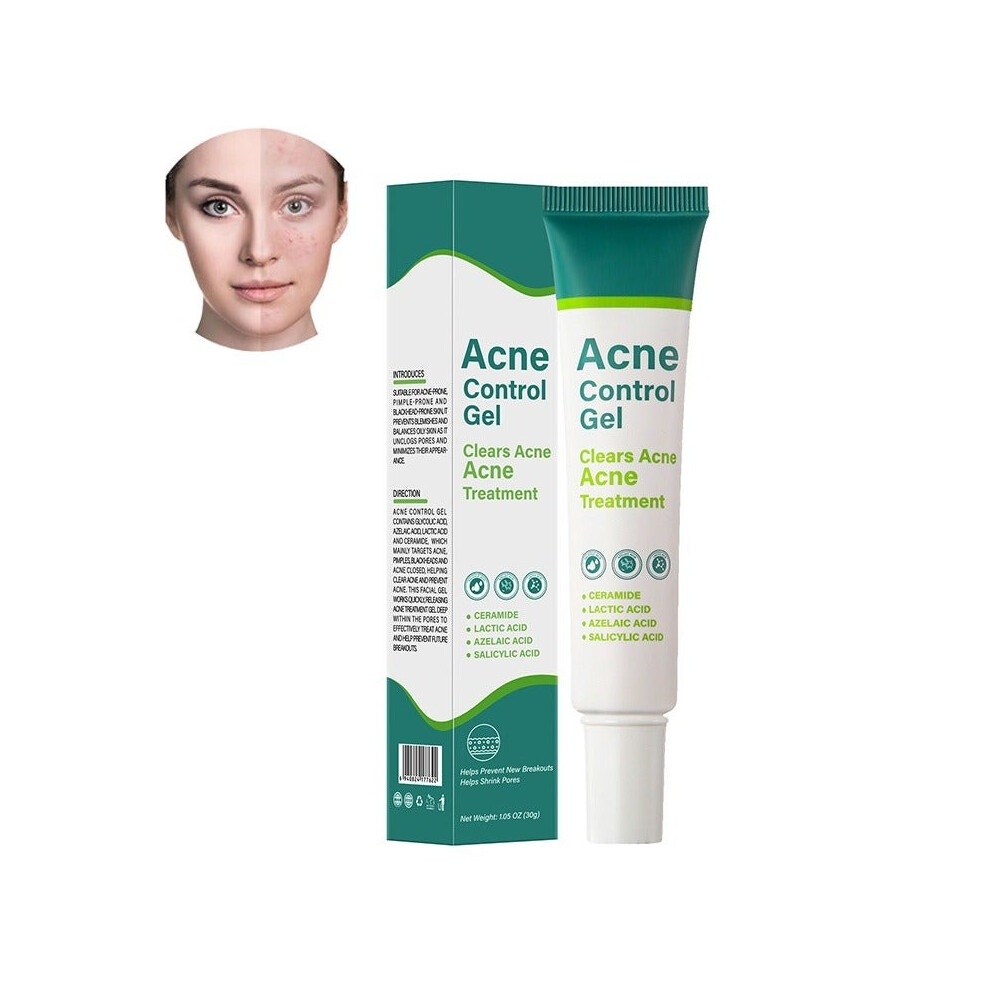 Cream Mooyam Acne Control Gel Clears Acne 30G | Acne Spot Gel | Pimple For Acne Prone Skin Care | Clear & Glowing Skin