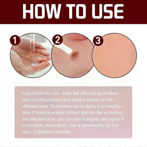(1pc)Liquid Wart Flat - Skin - refinement Solution 1