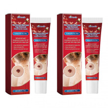 (2pcs)Bee-Venom Painless Wart Removal Cream Effective Moles Repairing Lotion for Hands Feet