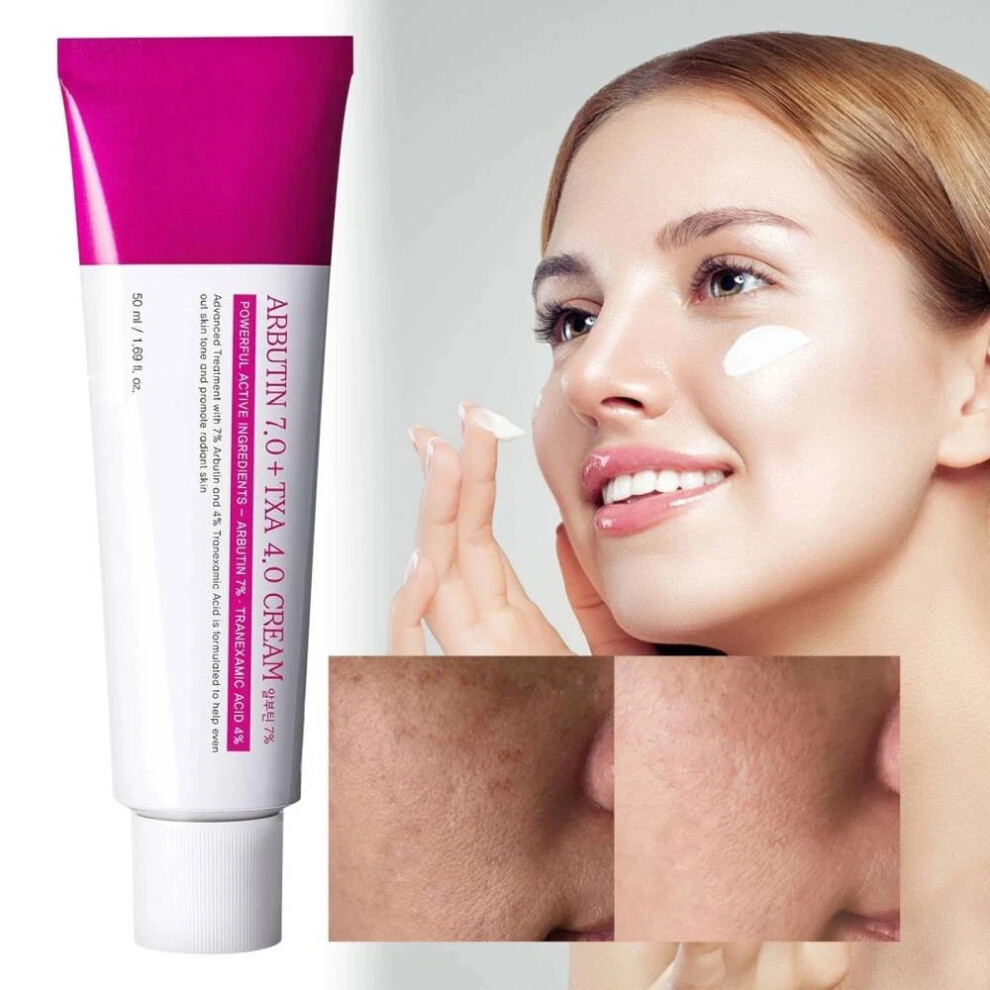 Cream Arbutin 7% Tranexamic Acid 4% Brightening Beauty Skin