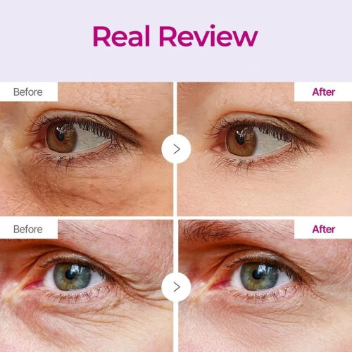 Cemenrete Calcium Volume Multi Balm Wrinkle Core Stick 2