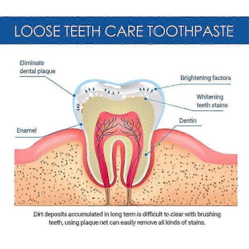 (2pcs) Gingival Fixation Toothpaste for Soothing Teeth & Gingival Pain by SOUTH MOON 1