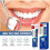 (2pcs) Gingival Fixation Toothpaste for Soothing Teeth & Gingival Pain by SOUTH MOON 5
