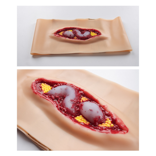 New Abdominal Anatomy Wound Training Model for Medical Teaching 1