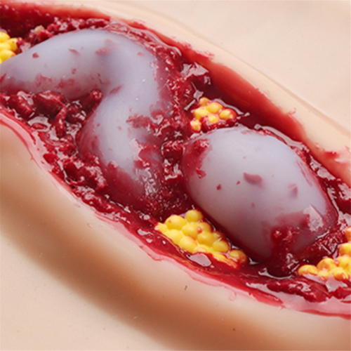 New Abdominal Anatomy Wound Training Model for Medical Teaching 2