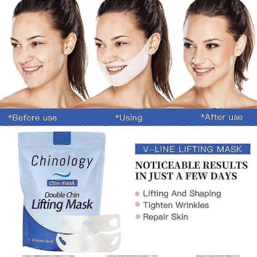 chinology double chin mask for v line lifting 2