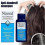 Dandruff Treatment Shampoo Nizoral 7 fl oz 200ml EXP 4