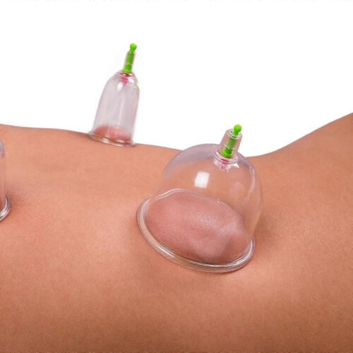 Cupping Set Professional Chinese Acupoint Cupping Massage Set 12 Cups 2