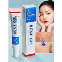 Kormesic Acne Gel 30ml | Pimple Cream for Acne Prone Skin Care for All Skin Types