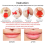 2Pcs Lips Enhancer Plumper Device Silicone Fish Sh 6