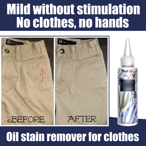 Stain Remover for Clothes Laundry Stain Remover 1